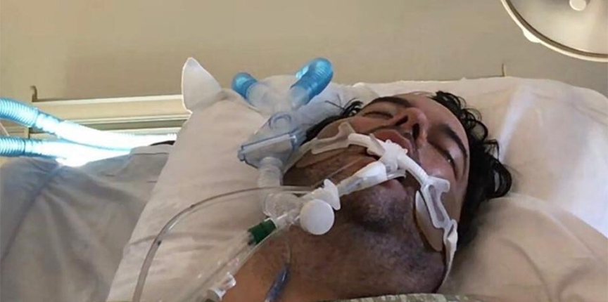 реанимация короновирус